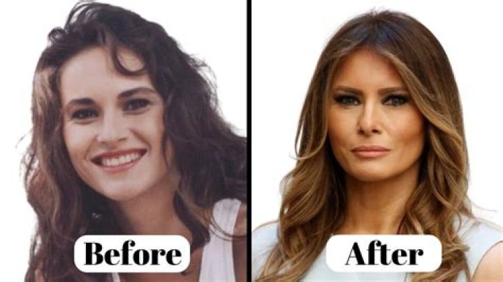 Alexis Maloney Before And After Photos- Plastic Surgery Details
