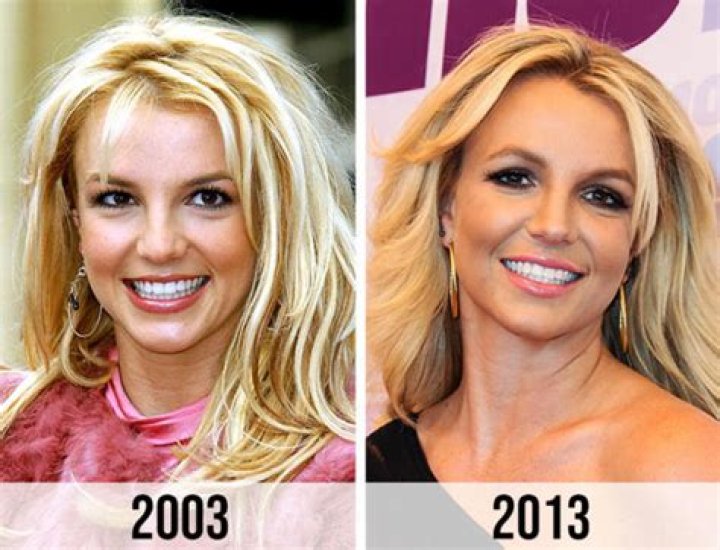 
Britney Haynes Plastic Surgery: Before And After 