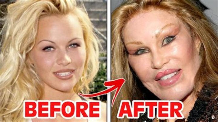 Clarissa Ward Surgery History, Did She Undergo Face Lift?