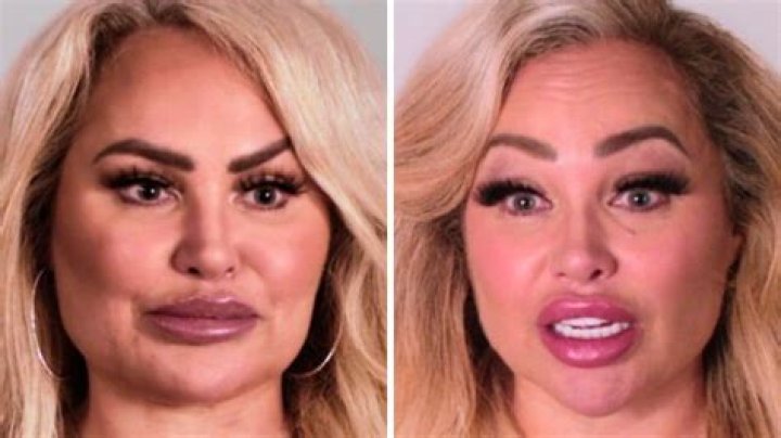 Darcey And Stacey Before And After Plastic Surgery 2021? Parents Nationality & Ethnicity