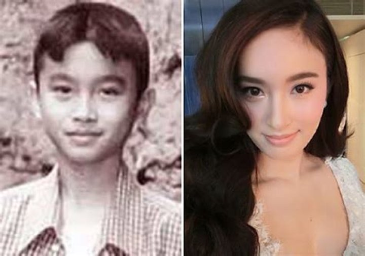 
Kevin Balot Plastic Surgery: Before And After Photos 