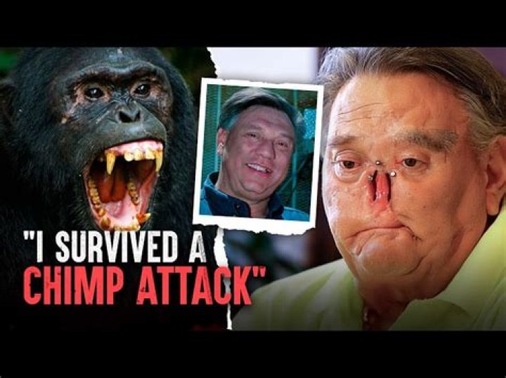 St James Davis Chimp Attack And Injuries, Before and After Photos On Twitter