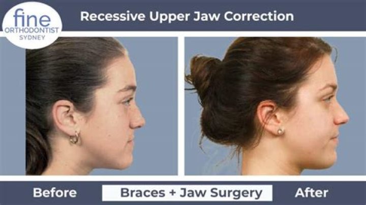 
“Surgery Is For Correction Not Perfection”-Blessing CEO Reacts After Being Dragged For Still Editing Her “Behind” Despite Surgery 