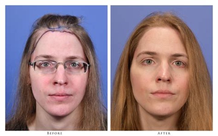Was Zeke Smith Born As Male Or Female? Before & After Transition Photos – What Did He Look Like As A Woman?